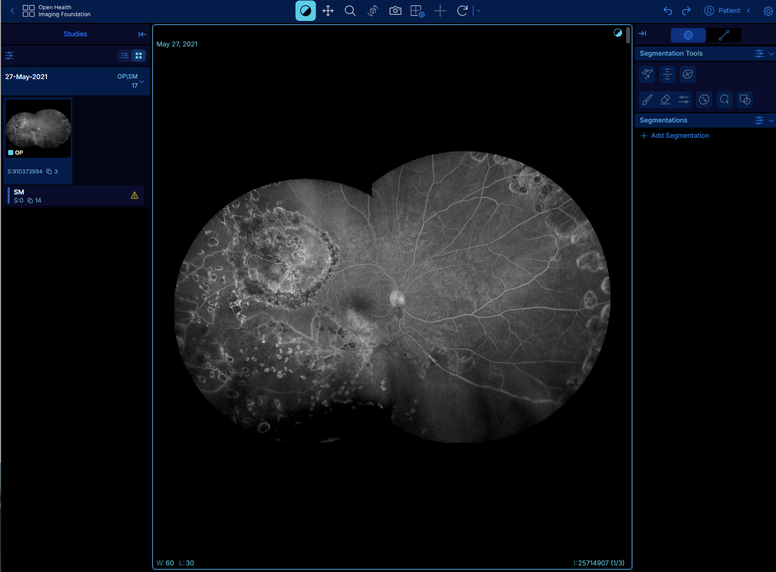Web Viewer